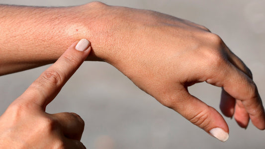 Stop the Itch Spray - Aromatics International